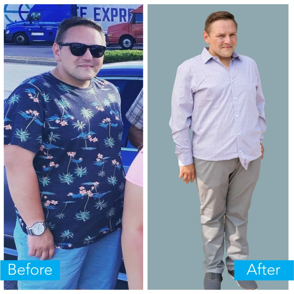 Andrew's before and after.