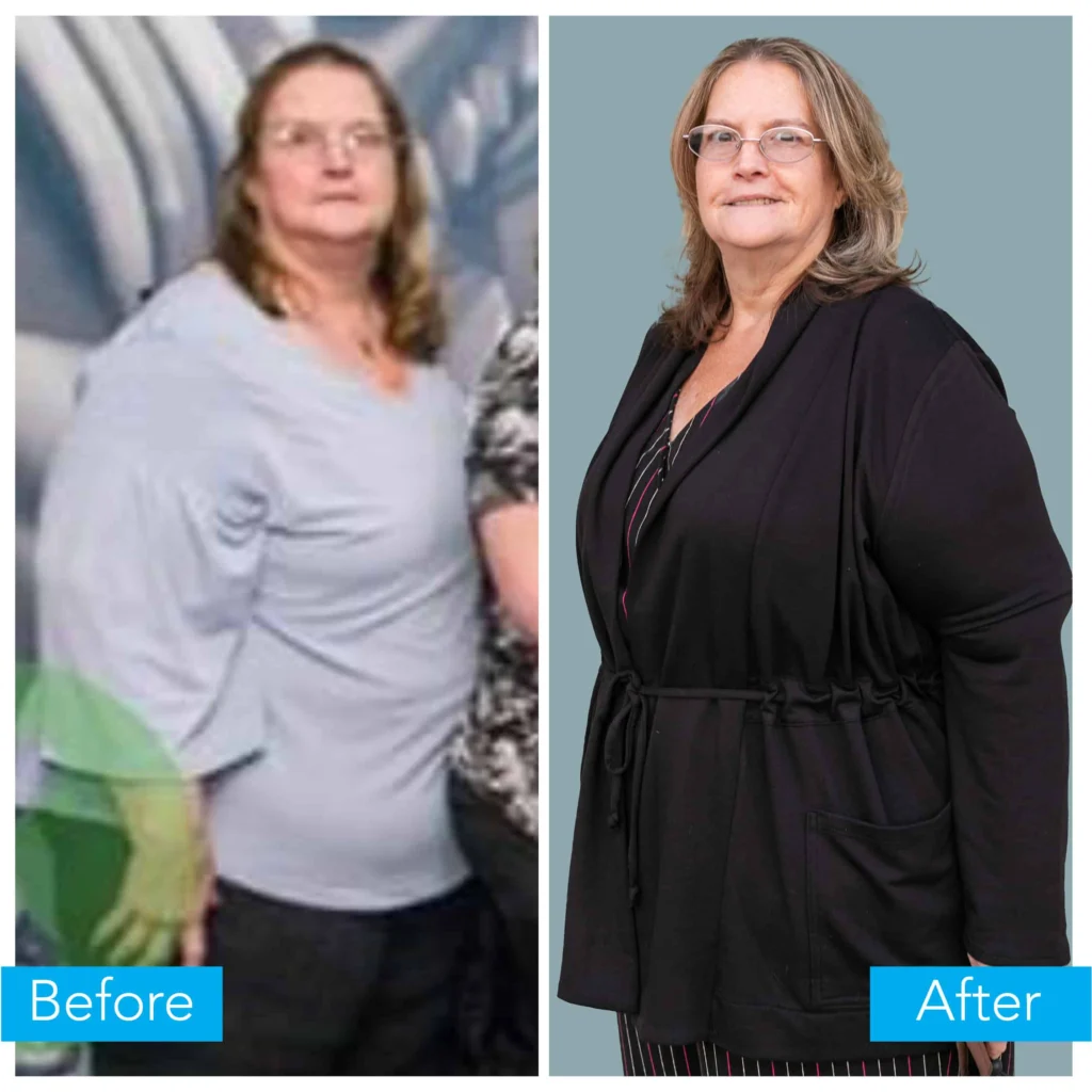 Jo Ellyn's before and after.